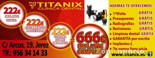 DENTISTA EN JEREZ 200€ IMPLANTE DENTAL EN TITANIX